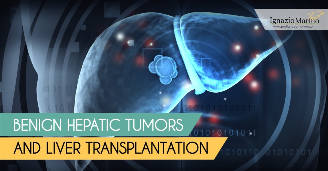 Ignazio Marino - Benign Hepatic Tumors and Liver Transplantation
