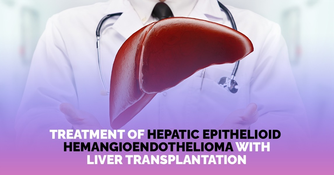 Umpredictable scientific research n.1: Treatment of Hepatic Epithelioid Hemangioendothelioma With Liver Transplantation