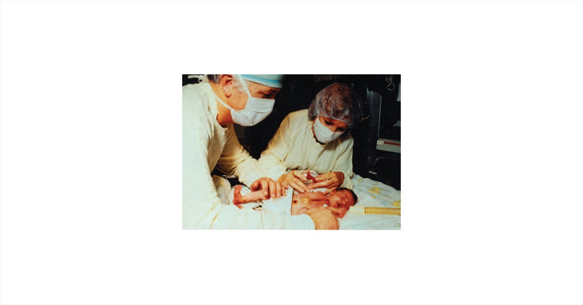 Figure 11. Baby Fae is Evaluated by Leonard Bailey and Sandra Nehlsen- Cannarella After the Cross-Species Infant Heart Transplant Performed at Loma Linda University Medical Center in 1984