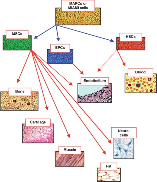 Ignazio Marino - Clinical Trials With Mesenchymal Stem Cells